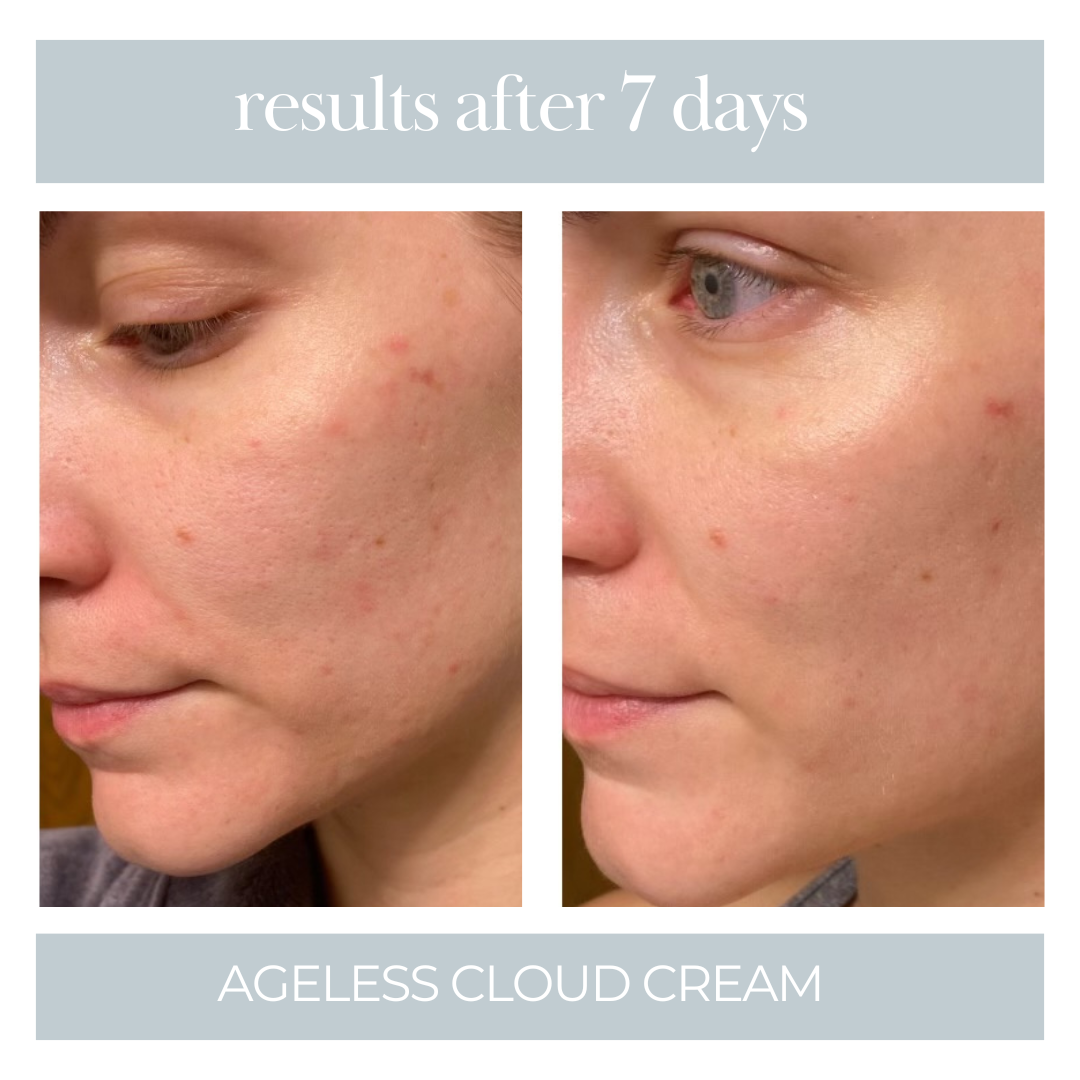 Ageless Cloud Cream