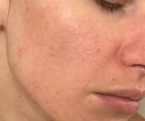after picture of using tallow lotion