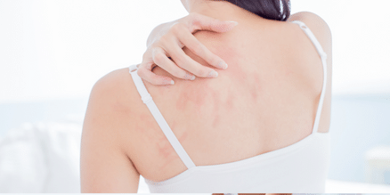 dry red itchy skin 
