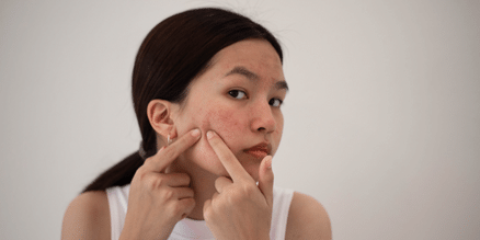 woman popping a pimple