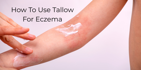 How To Use Tallow For Eczema