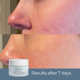 Ageless Cloud Cream before and after results after 7 days — cheek