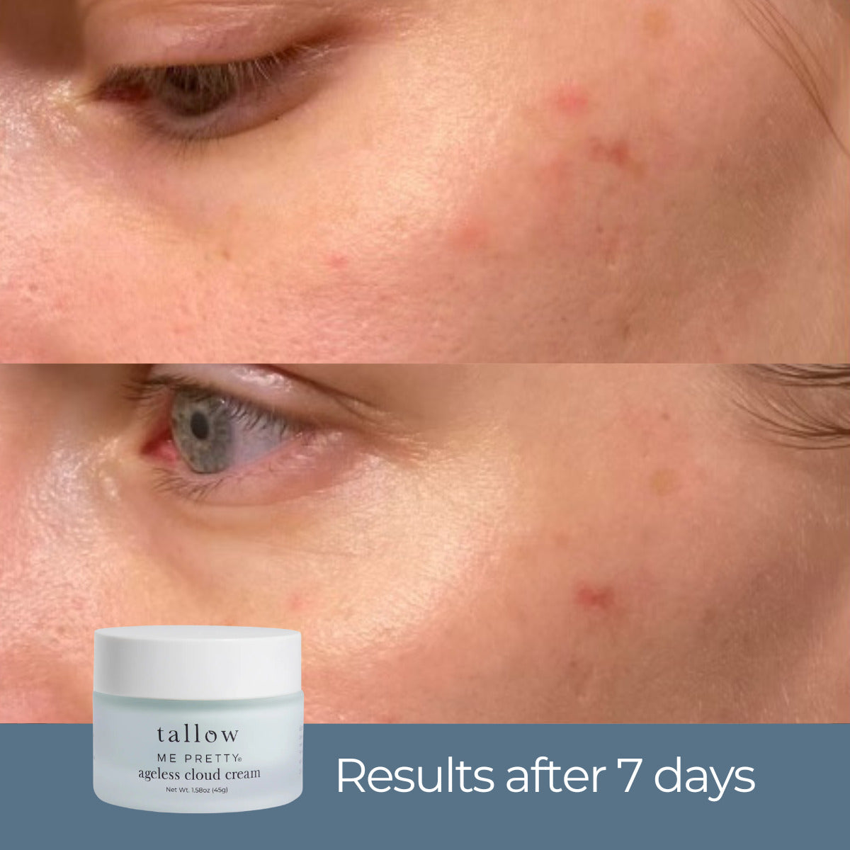 Ageless Cloud Cream before and after results after 7 days — under-eye