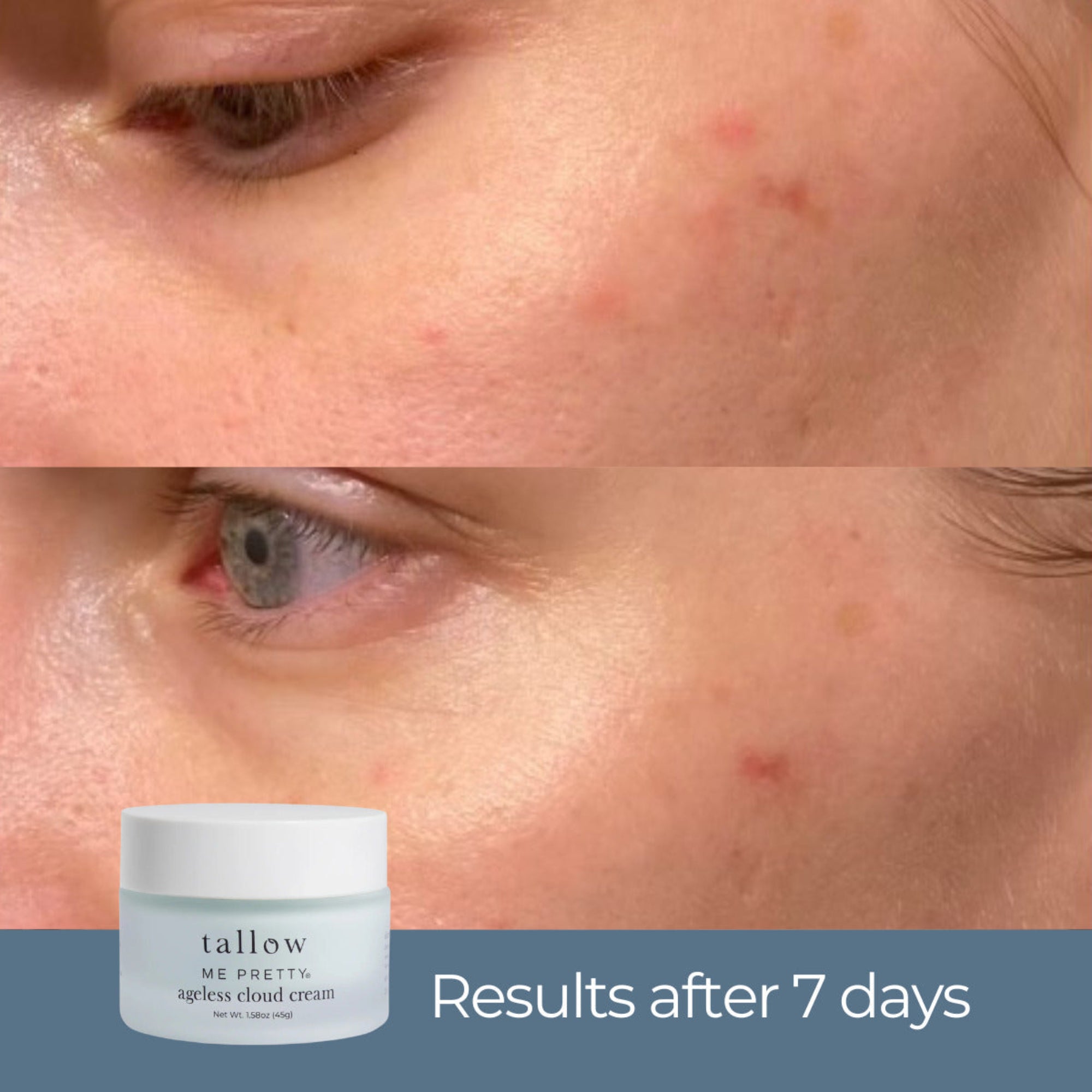 Ageless Cloud Cream before and after results after 7 days — under-eye