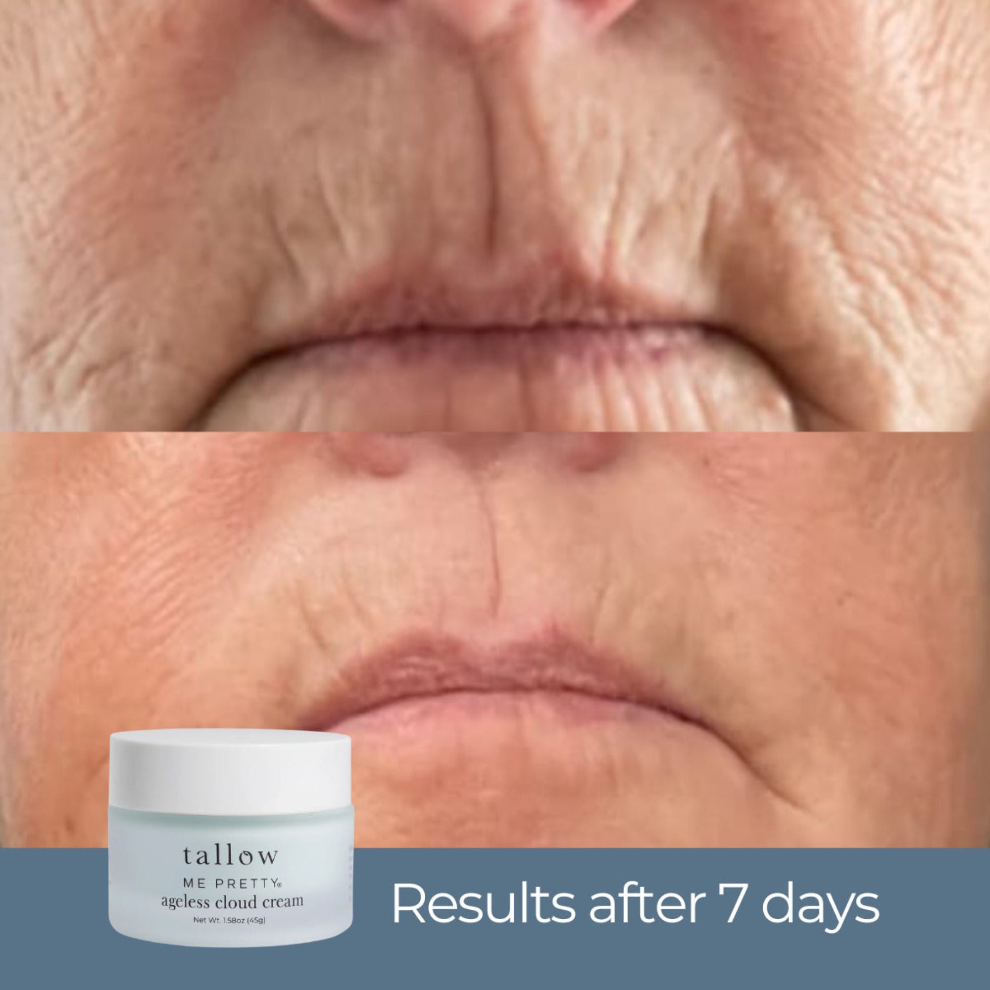 Ageless Cloud Cream before and after results after 7 days — smoother lip lines