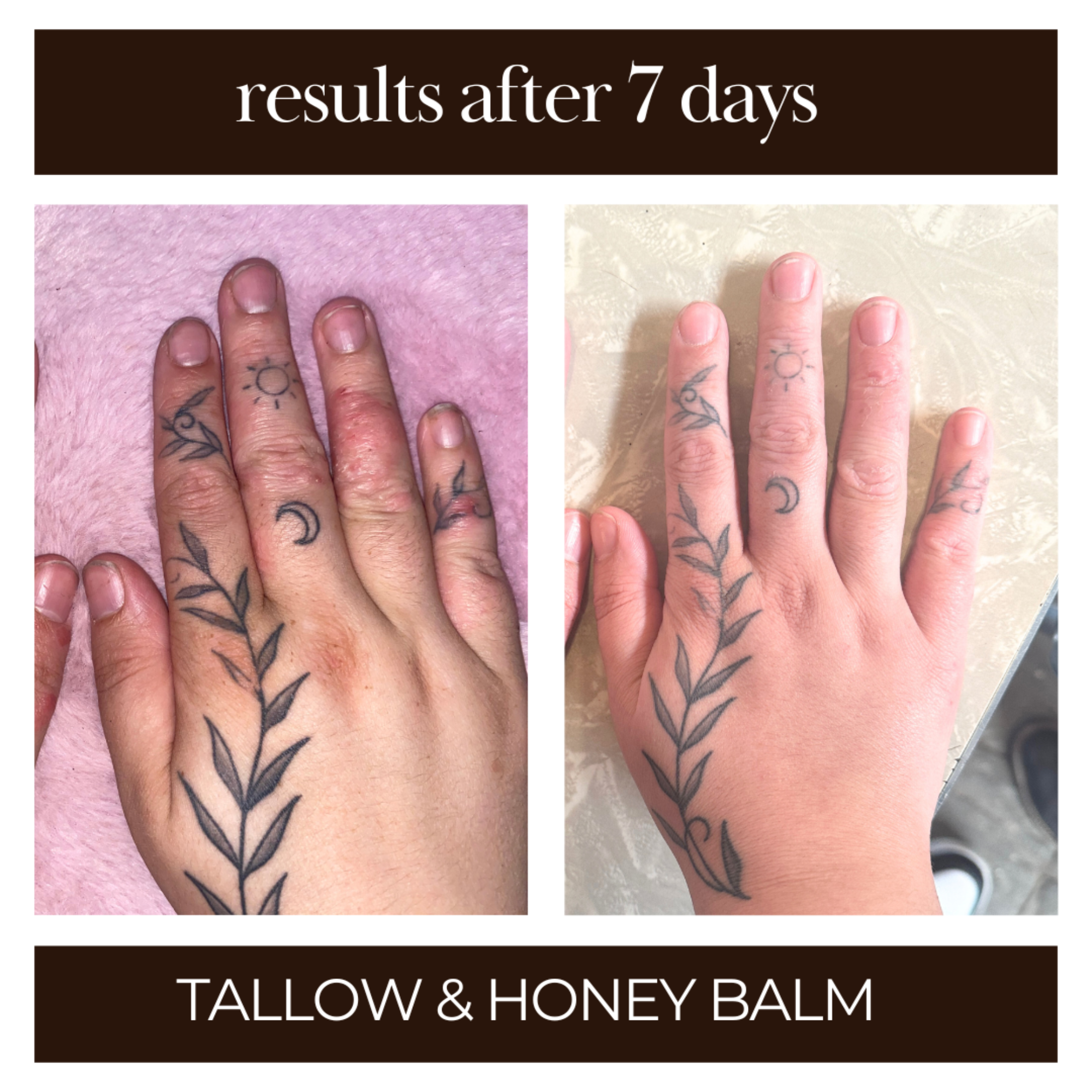 Healing results using Tallow & Honey Balm on cracked or irritated skin, showing restored moisture and smoother texture.