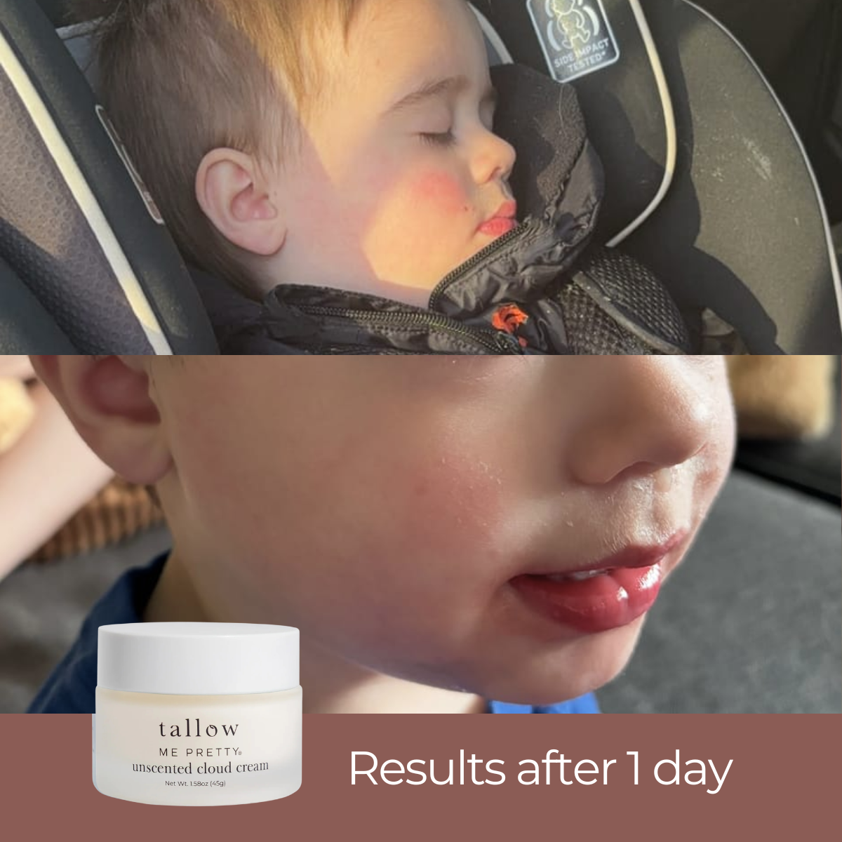 Unscented cloud cream for baby cheek redness and irritation — calmed skin after 1 day