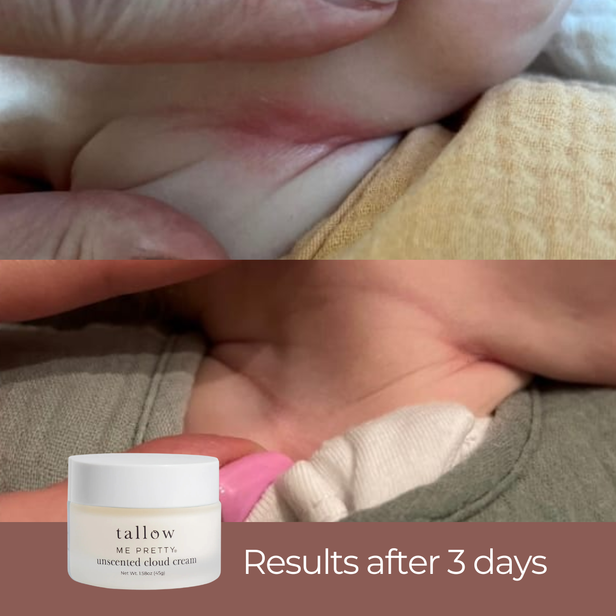 Unscented cloud cream for baby drool rash — visible results after 3 days
