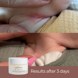 Unscented cloud cream for baby drool rash — visible results after 3 days