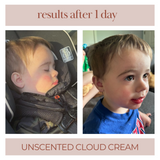 Before and after using Unscented Cloud Cream showing reduced redness and calmer sensitive skin.